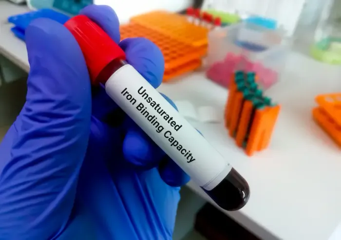 Understanding Total Iron Binding Capacity Test